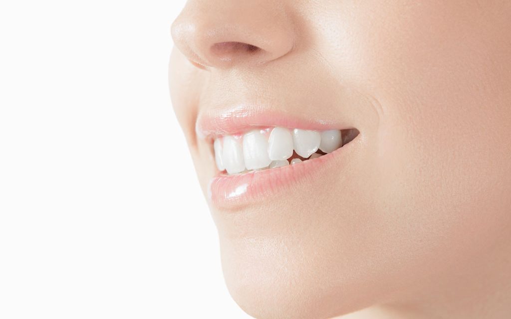 sbiancamento dentale