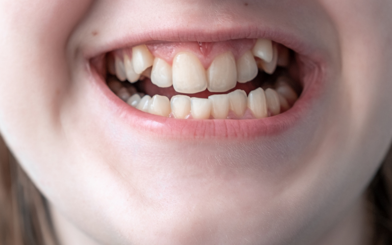 Gnatologia dentale
